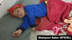 کودک مبتلا به سرخکان، بادغیس افغانستان