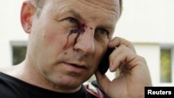 Журналіст Сяргей Грыц пасьля выкананьня прафэсійных абавязкаў і затрыманьня, 18 верасьня 2012 году
