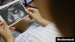 Folosirea medicamentelor de către femeile gravide trebuie făcută numai la recomandarea medicilor. 