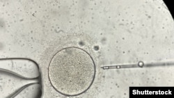 Mikroskopski prikaz vantjelesne oplodnje