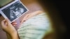 Një grua shtatzënë duke shikuar incizimin e foshnjës së saj. Fotografi ilustruese nga arkivi.