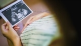 Žena gleda fotografiju bebe sa ultrazvuka, 2021.
