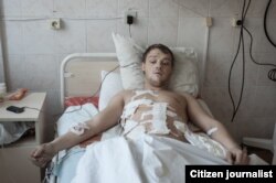 Aleksandr Gostev, separatist, 22 de ani, rănit în Gorlovka.