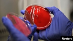 Soj bakterije escherichie coli