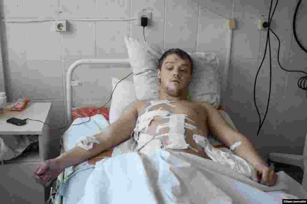 Donetsk, Ukrain. The city hospital. Alexandr Gostev, militiaman, 22 years old, from Gorlovka. He was wounded by machine gun bullet into chest, though lungs. It happened while his platoon was surrounded bu the Ukrainian army, he was resqued in the last mom
