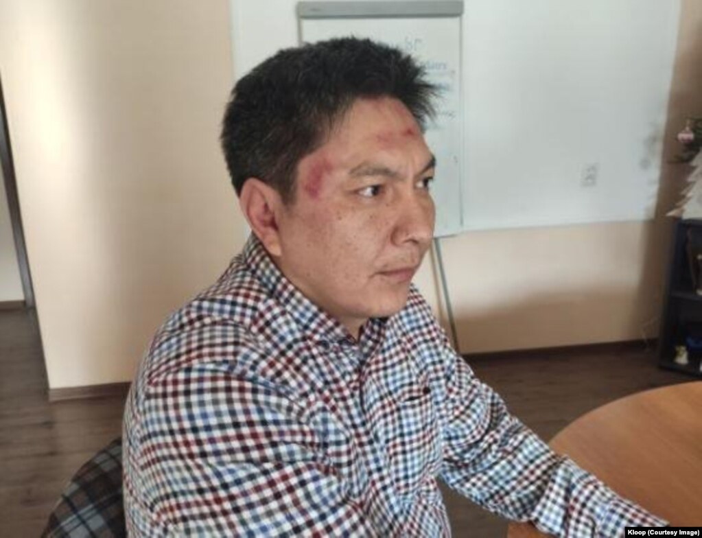 Bolot Temirov ubrzo nakon što je pretučen.