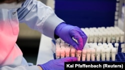 Laboratorijski radnik priprema uzorke za PCR testiranje