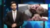 تازه ترین خبرهای جهان در ستودیوی آزادی