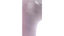 В центральной городской больнице Дальнегорска, отделение для пациентов с коронавирусом