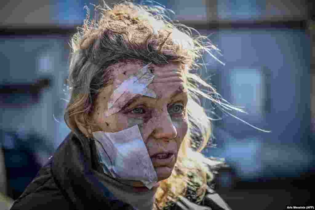 Elena, profesoară în vârstă de 53 de ani din localitatea Ciuhuiv din estul Ucrainei, a fost rănită de o explozie după ce Rusia a invadat țara, pe 24 februarie. Mai târziu, ea le-a spus jurnaliștilor că a urmărit știrile, dar, ca mulți oameni, nu a crezut niciodată &bdquo;că va începe cu adevărat un război&rdquo;.