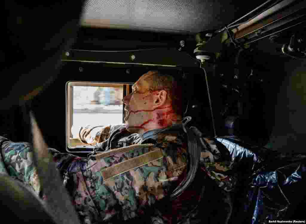 A wounded Ukrainian serviceman is evacuated from the front lines in Syevyerodonetsk on June 2.&nbsp; As of&nbsp;June 3 bitter fighting in eastern Ukraine is ongoing as Russian forces continue their assult. Ukraine&#39;s President&nbsp;Volodymyr Zelenskiy says &quot;60 to 100&quot; Ukrainian soldiers are dying in battle every day.&nbsp;