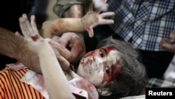 Ребенок, пострадавший при боевых действиях в пригороде Дамаска. 12 сентября 2016
