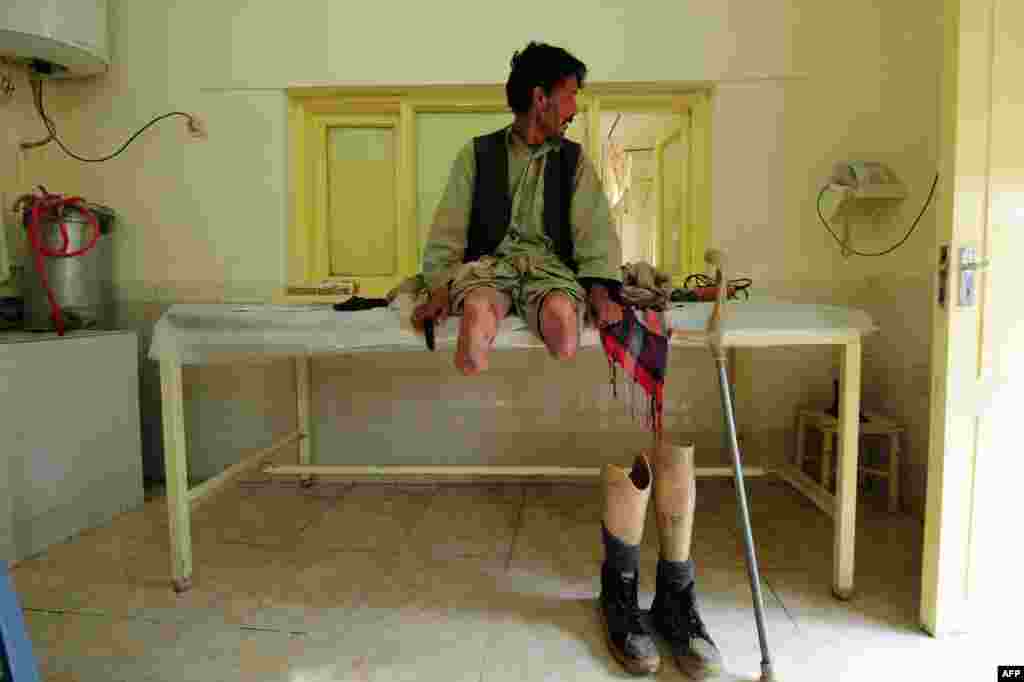 An Afghan amputee waits for the doctor at the International Committee of the Red Cross (ICRC) hospital for war victims and the disabled in Mazar-e Sharif. The ICRC Orthopedic Project, which began in 1988 in Kabul, now has seven centers in various Afghan provinces. (AFP/Qais Usyan)