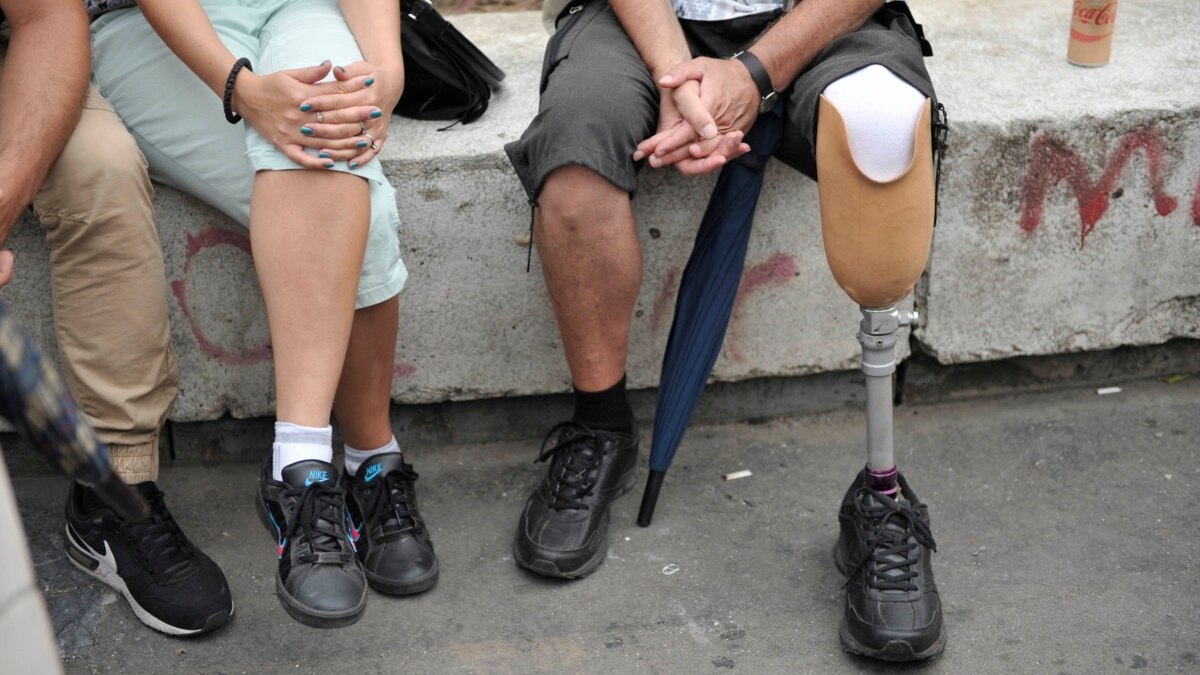 In Russia, there is a shortage of prostheses for those returning from the war in Ukraine