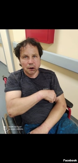 Николай Гордиенко в больнице через несколько дней после нападения на него сотрудниками силовых структур