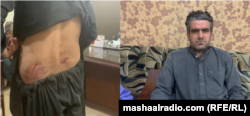 عبدالمتین اڅکزی د خیبر ټي وي خبریال خپل ټپونه ښيي. ۲۰۲۰، ۲۲ جون