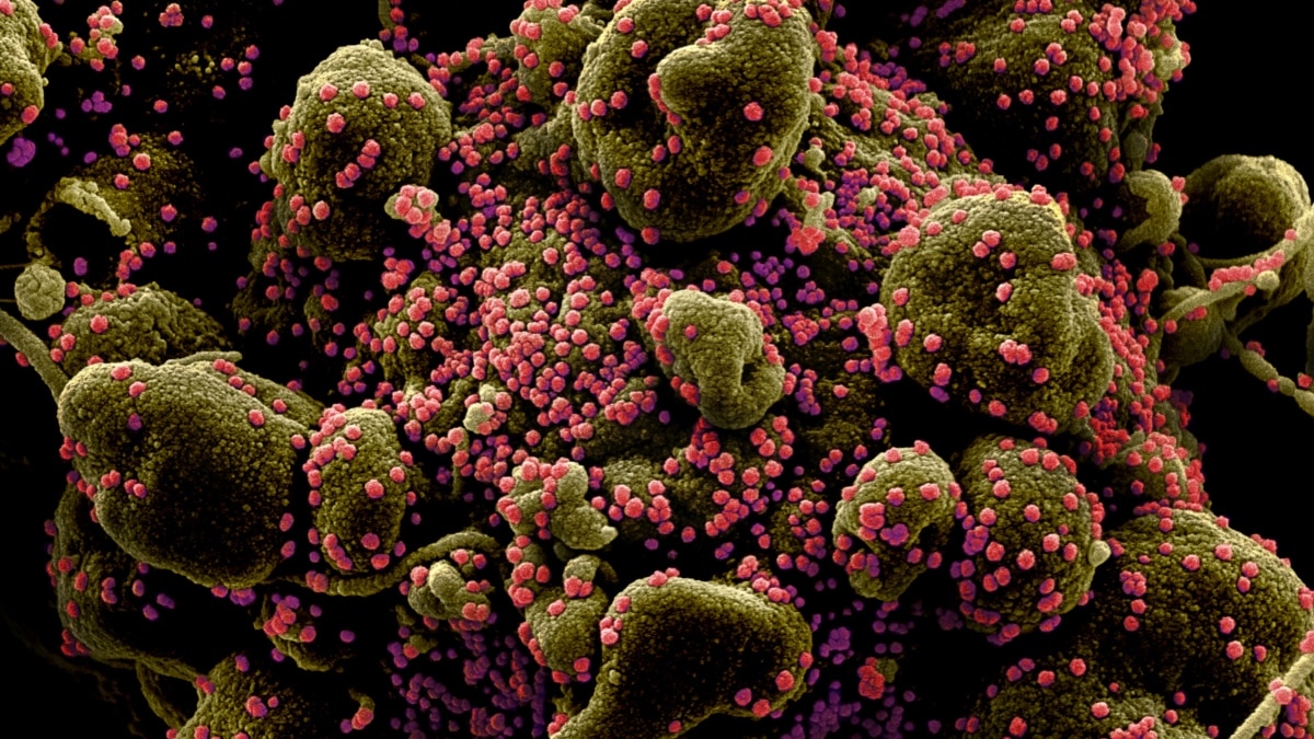 scanning electron microscope virus