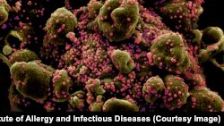 Како напаѓа коронавирусот, микроскопски фотографии