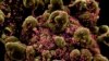 Фрагмент людської клітини, інфікованої коронавірусом