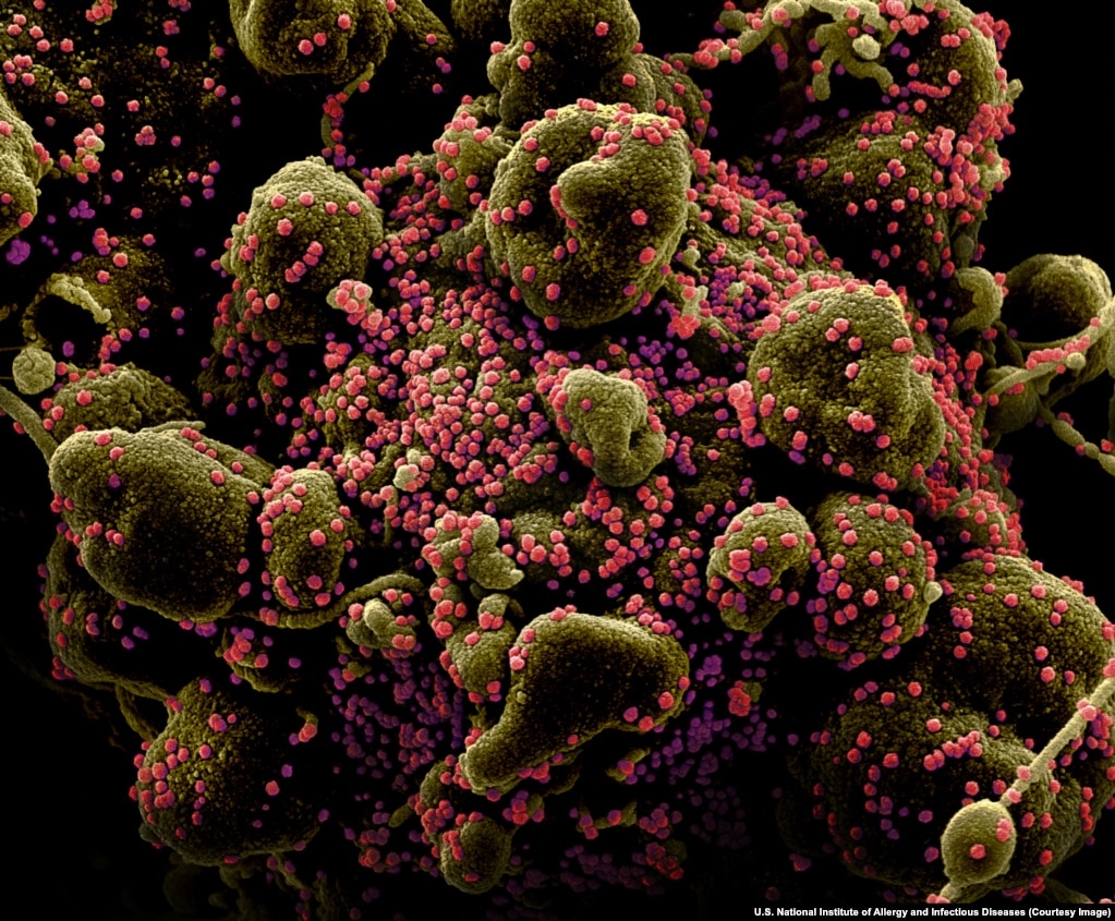 Деталь клітини людини, інфікованої SARS-CoV-2. Покинувши людський організм, вірус, як вважається, може проіснувати на деяких поверхнях до декількох днів