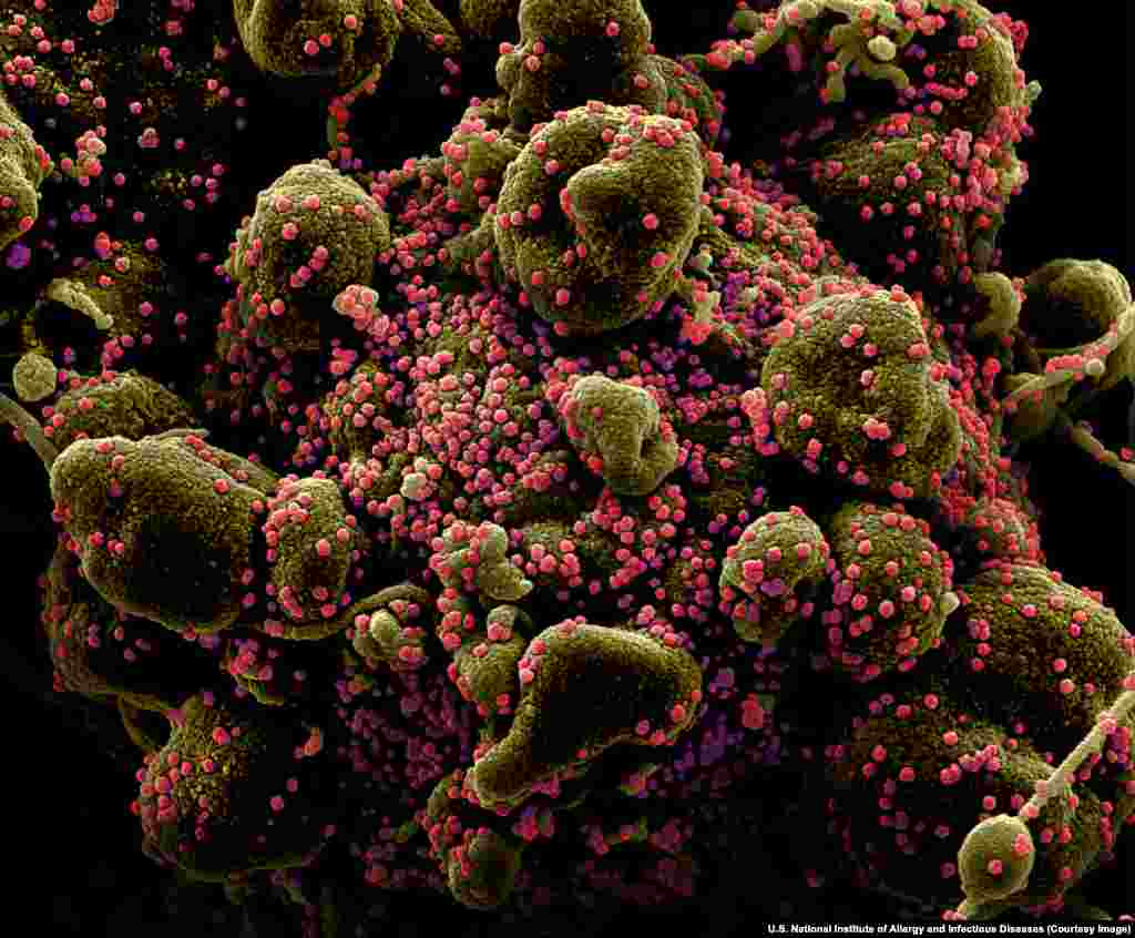 Деталь клітини людини, інфікованої SARS-CoV-2. Покинувши людський організм, вірус, як вважається, може проіснувати на деяких поверхнях до декількох днів