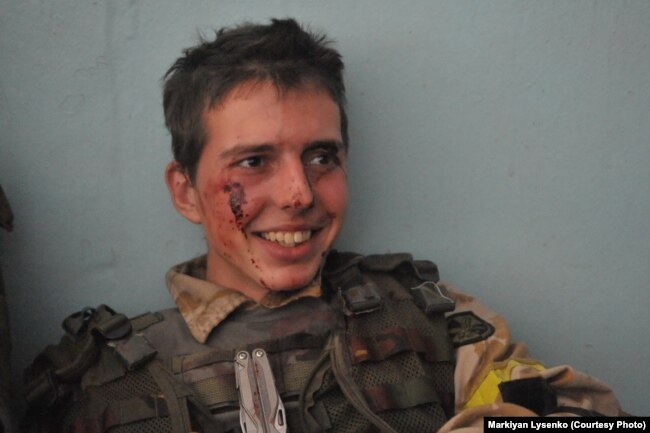 Один из самых молодых бойцов добровольческого батальона ранен после атаки. Иловайск, август 2014 года. Фотограф Маркиян Лысенко