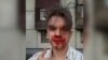 Pyotr Ivanov suffered a concussion in the attack as well as cuts and contusions to his head.
