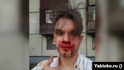 Gazetari rus, Pyotr Ivanov u sulmua më 30 maj në Shën Pjetërburg nga persona të paidentifikuar.