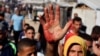 Palestinac pokazuje mrlju od krvi na dlanu nakon što je nosio ranjene u izraelskom napadu koji su čekali na humanitarnu pomoć, Kan Junis, jugu Pojasa Gaze, 29. maja 2025.