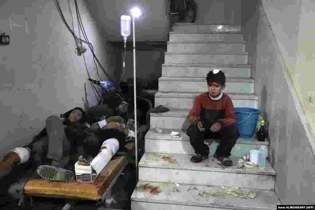 Wounded Syrians wait to receive treatment at a makeshift hospital in Kafr Batna in the besieged eastern Ghouta region on the outskirts of the capital, Damascus, following Syrian government bombardments on February 21. (AFP/Amer Almohibany)