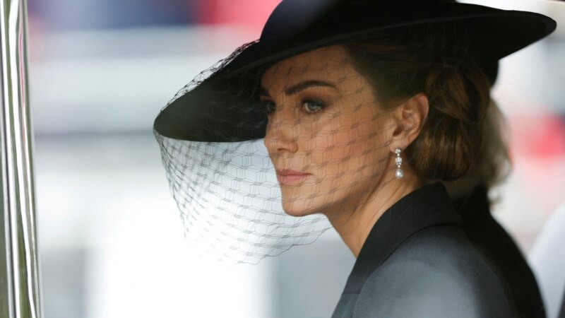 Pse agjencitë e fshinë fotografinë e parë zyrtare të Princeshës së Uellsit pas operacionit?
