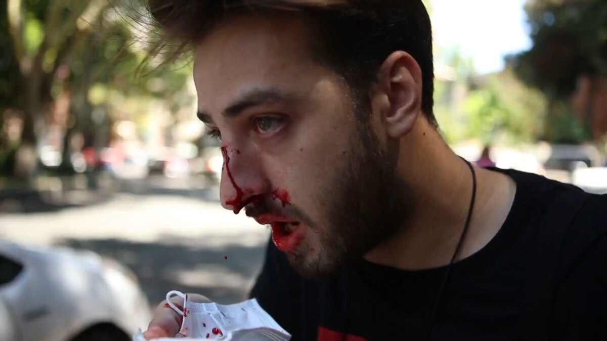 Anti-LGBT Protesters Attack Journalists In Tbilisi, Force Organizers To Cancel Pride Event