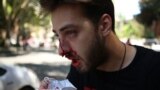 Anti-LGBT Protesters Attack Journalists In Tbilisi, Force Organizers To Cancel Pride Event