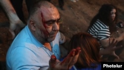 Armenia - An opposition supporter is injured in clashes between protesters and riot police, Yerevan, June 3, 2022.