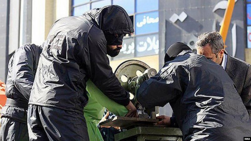 عکس مربوط به اجرای حکم قطع انگشتان دست یک سارق در مشهد در ملاء عام است