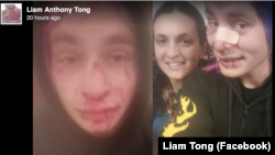 Liam Tong wrote that his injuries from the attack included a fractured nose and damage to several of his teeth that left him in excruciating pain.