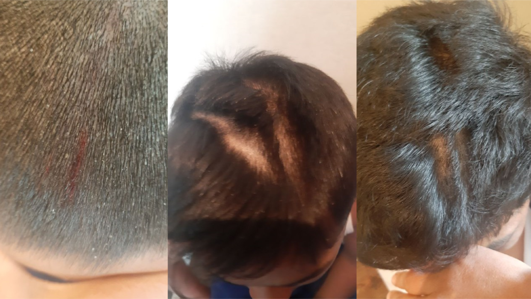 Tanlangan kaltak bilan jinsiy aloqa