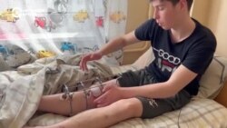 «Лежишь и думаешь: «Боже, за что тебе это?» Истории подростков из Луганской области, раненных во время российских обстрелов