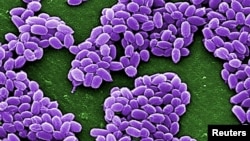"Bacillus anthracis" bakteriýasynyň ulaldylan şekili (Reuters)