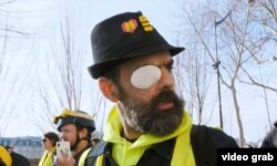 Кадр из фильма: Жером Родригез, один из лидеров "желтых жилетов", получивший ранение во время столкновений с полицией