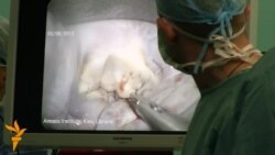 Перша у Східній Європі відеоторакоскопічна операція на серці з мінімальним розрізом