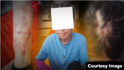 Күйөөсүнүн ур-токмогунан запкы жеп жашап келаткан Каныш төрт баланын энеси. 