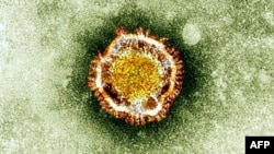 Электрондық микроскоппен қарағандағы коронавирустың түрі.