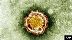 «Тәж вирусының» (coronavirus) электрондық микроскоптан қарағандағы көрінісі. Ұлыбритания денсаулық сақтау агенттігі таратқан сурет.