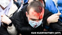 Uprkos brutalnosti ruske policije prema svojim građanima, pojedine proruske grupe u Srbiji ni u ovakvom primeru nisu narušile svoju pozitivnu sliku o predsedniku Rusije Vladimiru Putinu. Moskva, povređeni učesnik protesta, 23 januar 2021.