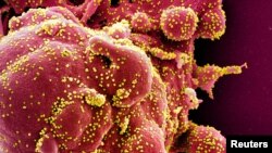 Клетка (красная), заражённая вирусами SARS-CoV-2 (жёлтые), обработанное изображение электронного микроскопа