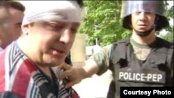 Снимателот на Телма Жарко Пачемски беше повреден на протестите пред општина Чаир. Тој беше погоден со камен во глава. Фото: ТВ Телма.