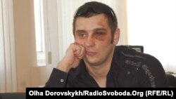 Donetsk journalist Artyom Furmanyuk says he was beaten by the police.