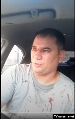 Блогер Джурабек Омонов после избиения в консульском отделе.