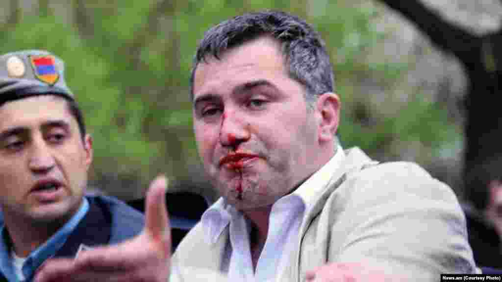 Armen Martirosian of Armenia&#39;s Heritage party is detained by police while participating in the opposition rally.